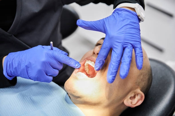 Best Emergency Treatment for Dental Infections or Abscesses in London, CA