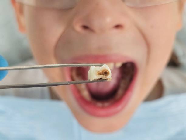 Best Emergency Orthodontic Services in London, CA